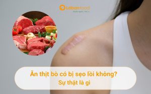 ăn thịt bò có bị sẹo lồi không