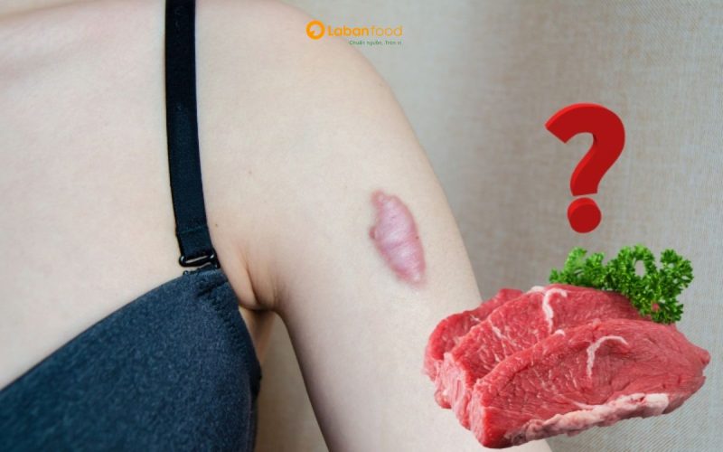 bà đẻ có nên ăn thịt bò không