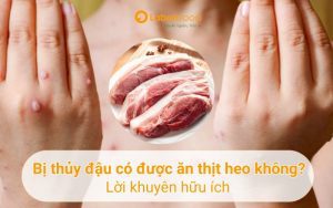 bị thủy đậu có được ăn thịt heo không
