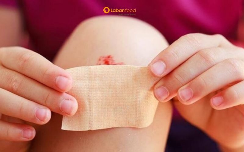 bị vết thương hở có nên ăn thịt bò không