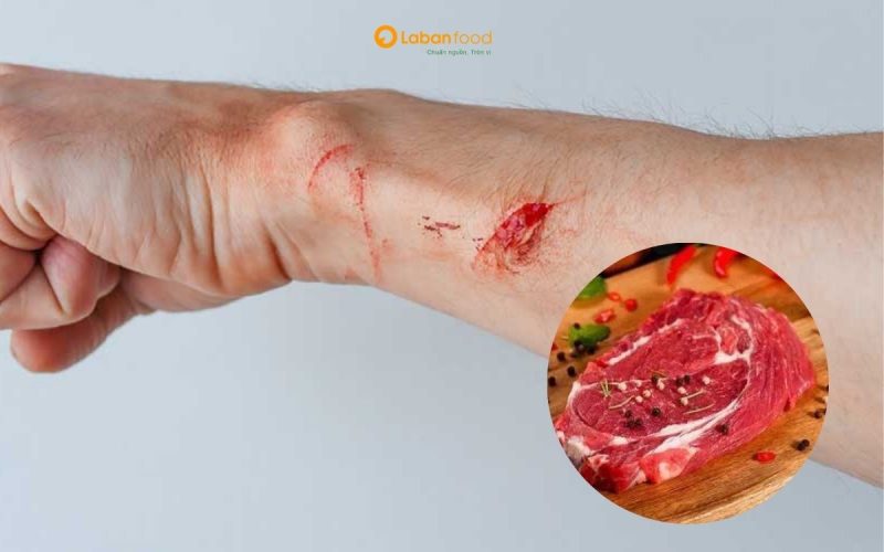 bị vết thương hở có nên ăn thịt bò không