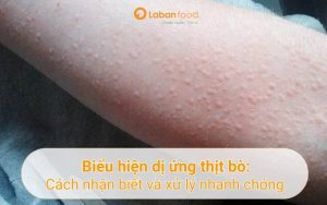 biểu hiện dị ứng thịt bò