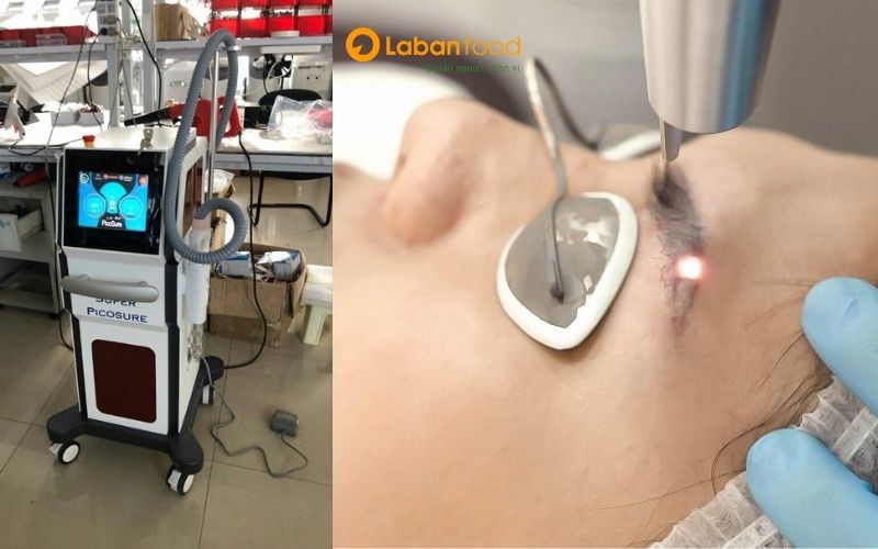 xoá xăm có được ăn thịt bò không
