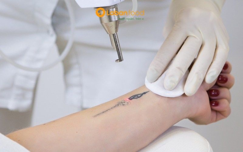 xoá xăm có kiêng thịt bò không