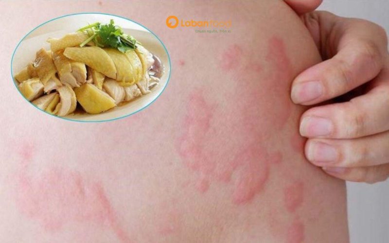 bị viêm tai giữa có nên ăn thịt gà